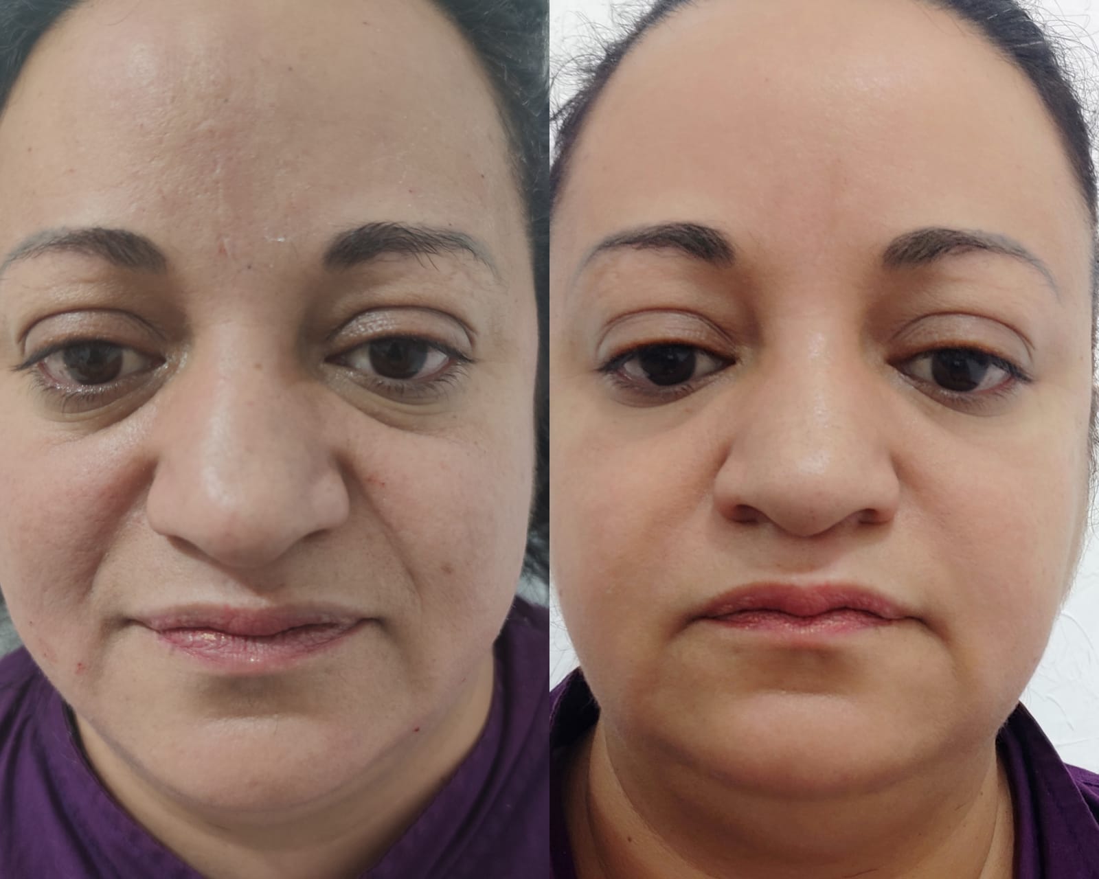 Tratamento Facial e Corporal.